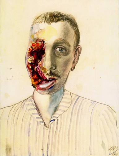 Otto Dix, Wounded Veteran, 1922. Watercolor and pencil, 19 1/4 x 14 1/2 inches.