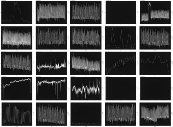An image featuring a grid of graphs. Each graph depicts a white line against a black background. Each graph is unique indicating unique levels of movement.
