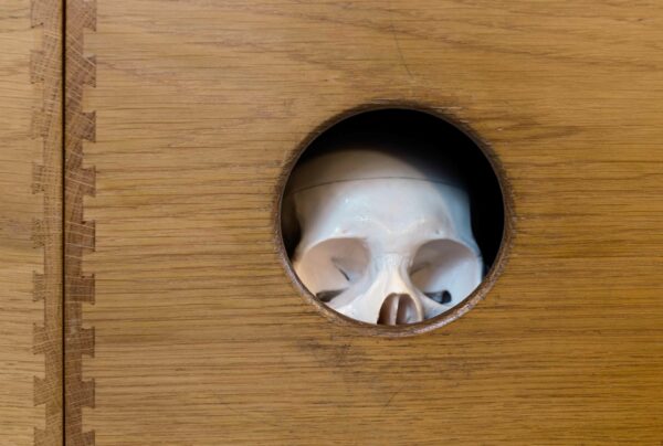 Photo of a plastic skull in a wood box
