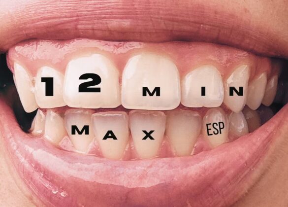 A designed graphic featuring a close-up of a smiling mouth with the text "12 MIN MAX ESP" on the teeth.